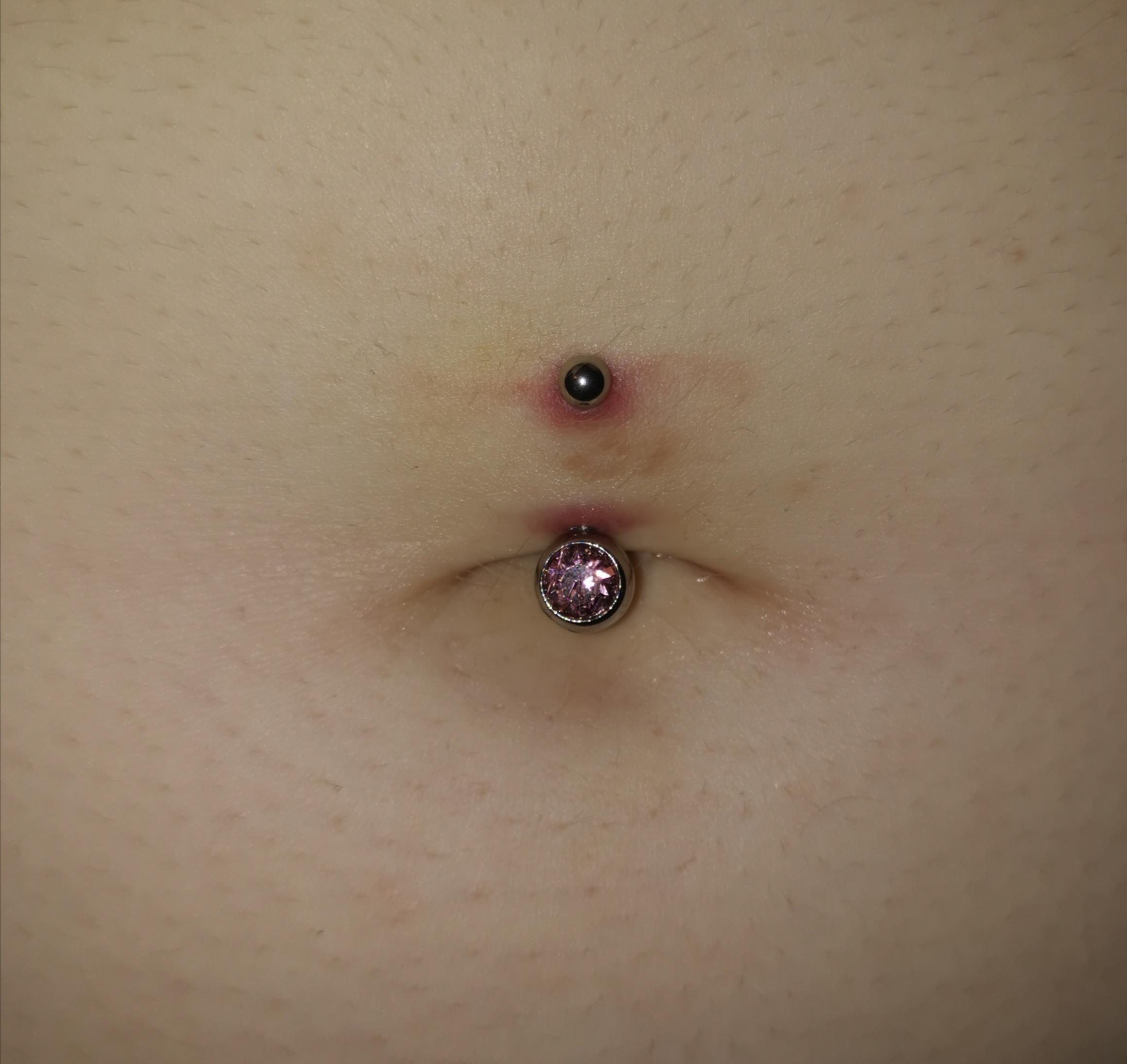 Bauchnabelpiercing Brauner Fleck Gesundheit Und Medizin Flecken Piercingschmuck