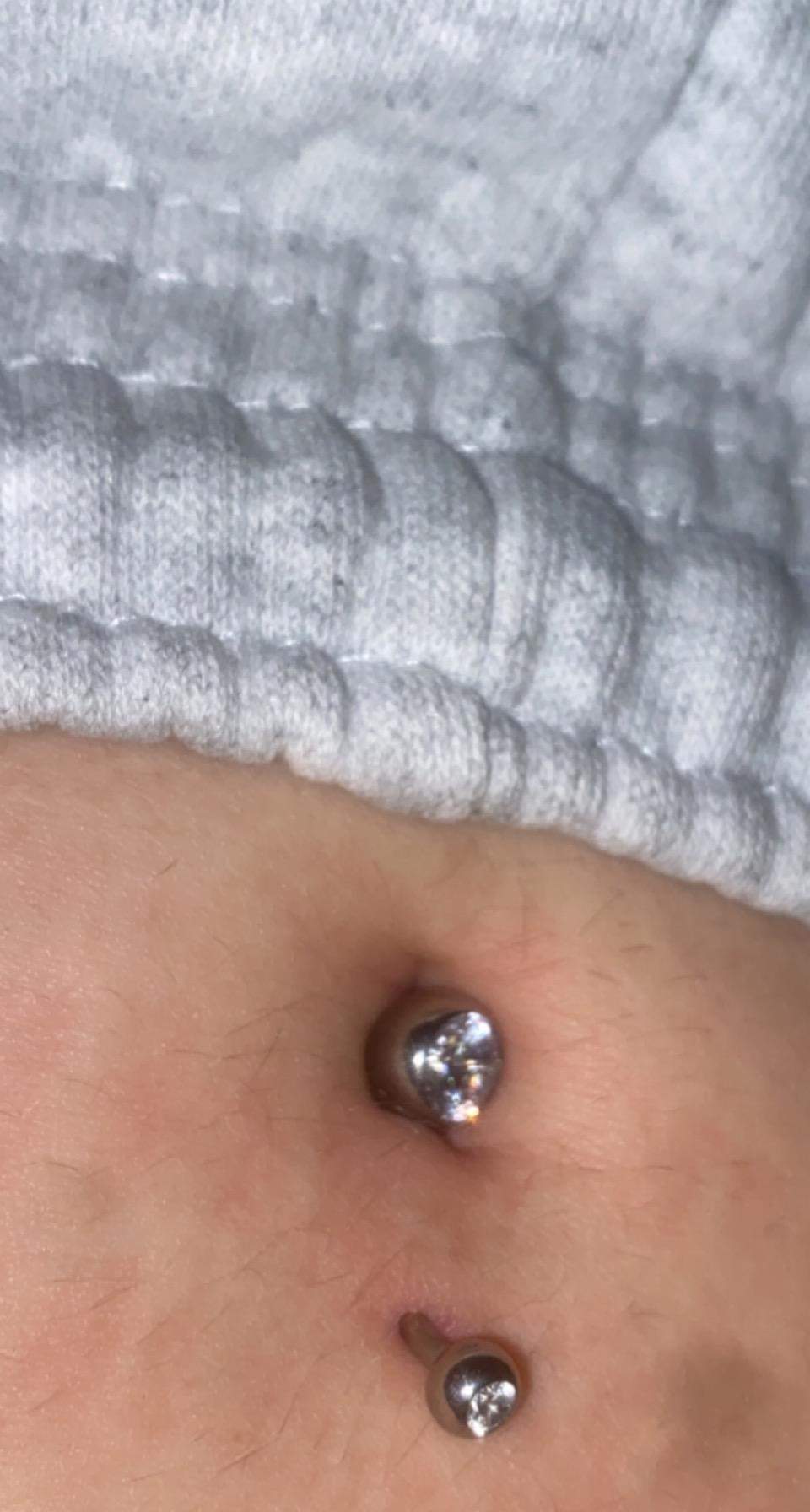 Bauchnabelpiercing Eitert Aber Tut Nicht Weh