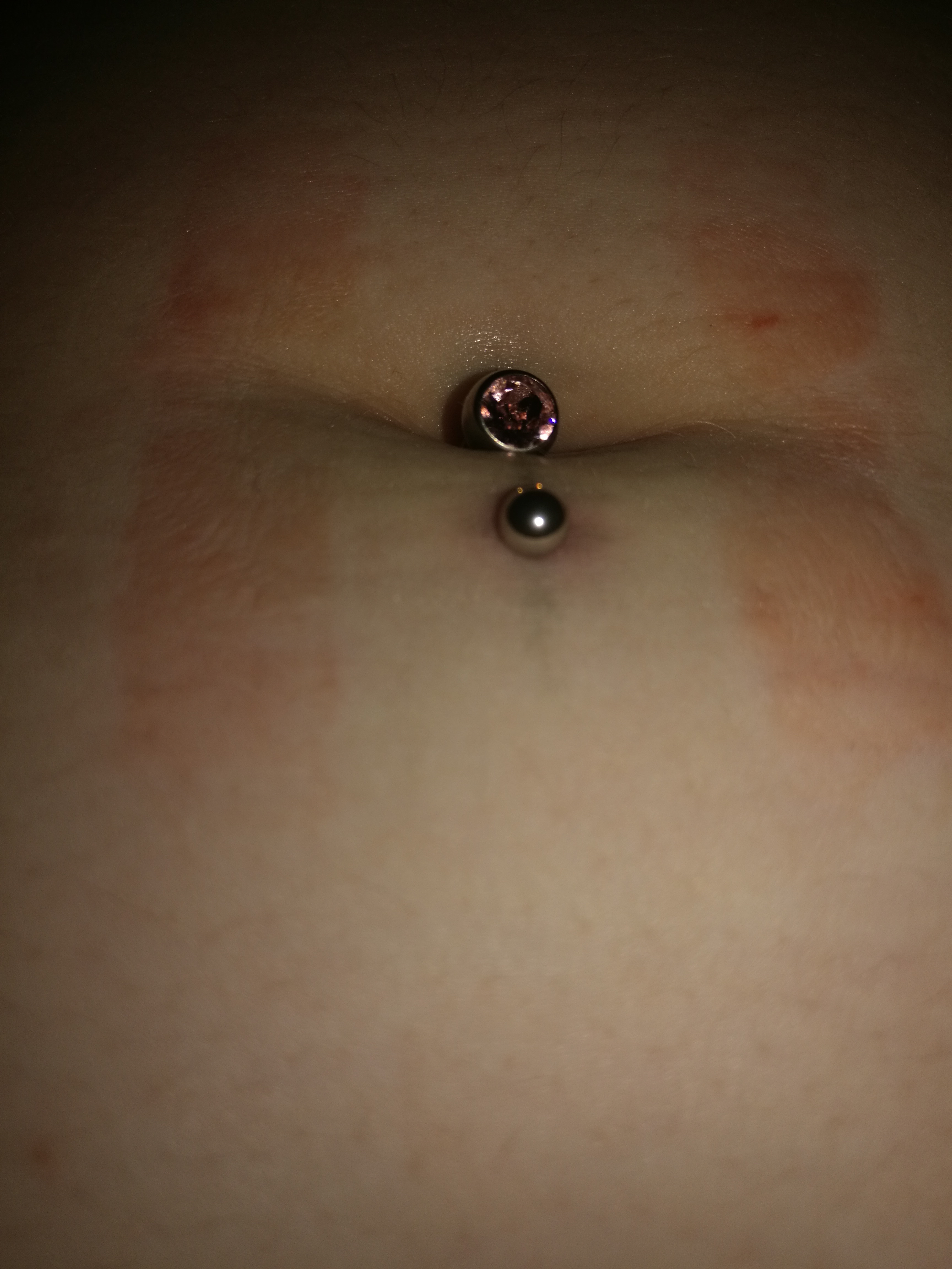 Wie Schnell Wächst Ein Bauchnabelpiercing Zu