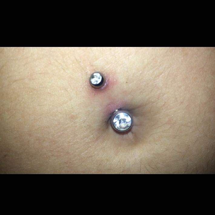 Bauchnabelpiercing wechseln trotz wundsekret