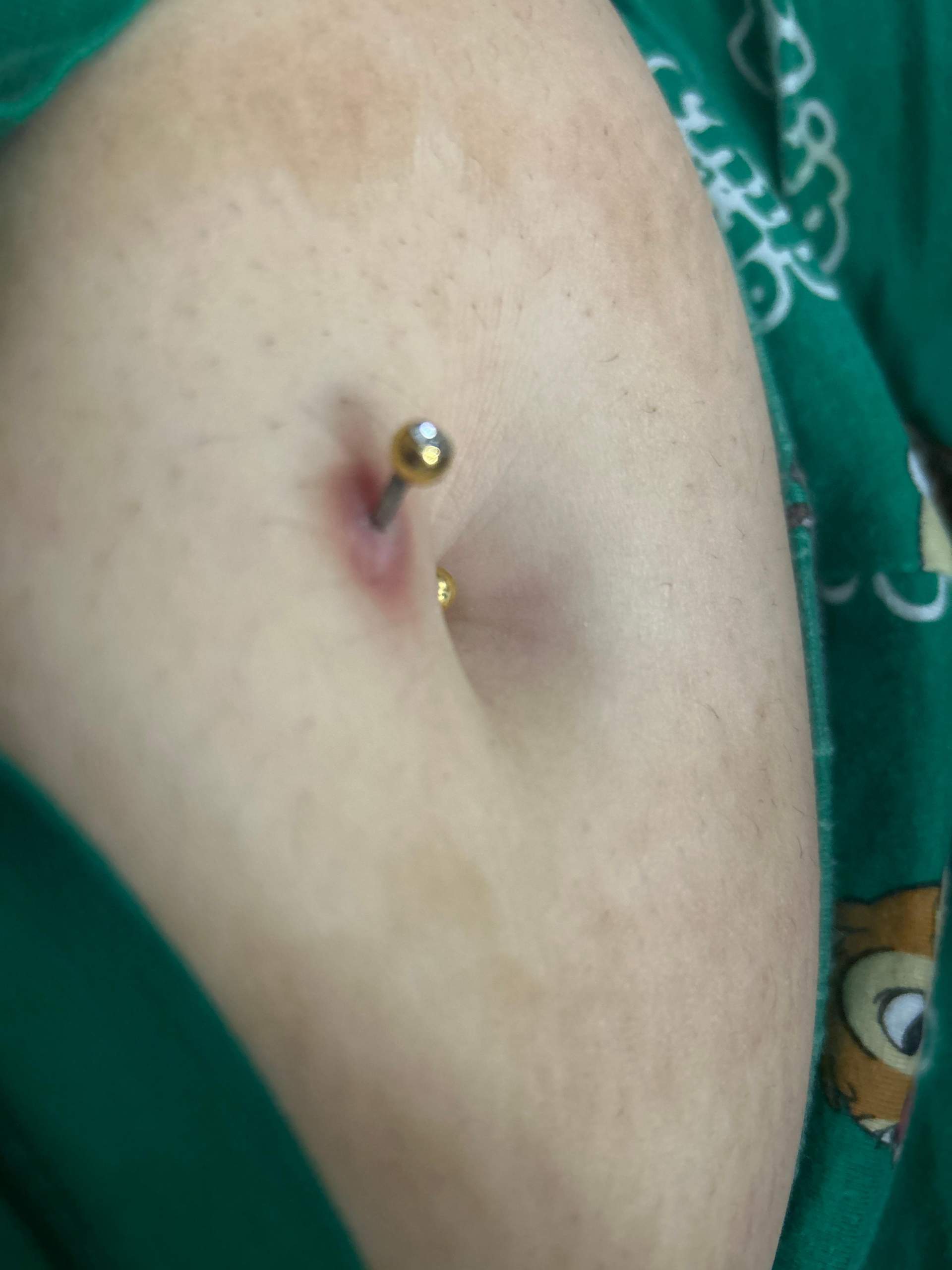 Bauchnabelpiercing Heilung? (Schmerzen, Piercing, Entzündung)