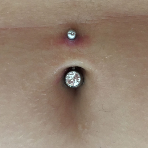 Zu sehen das Piercing mit der Rötung  - (Gesundheit und Medizin, Entzündung, Bauchnabelpiercing)