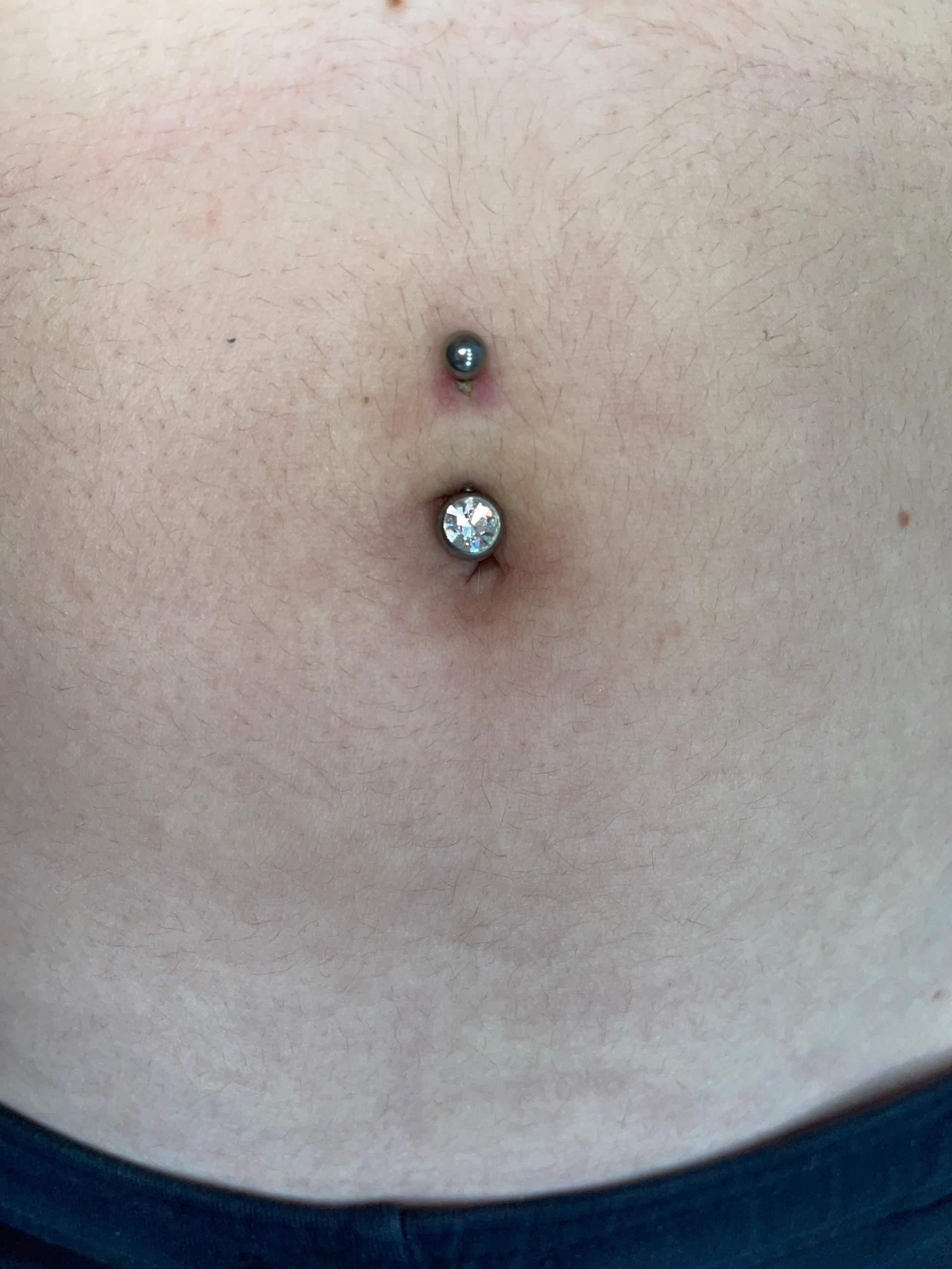 Bauchnabelpiercing ist um obere Kugel rot und Haut „klebt“ fest an ...
