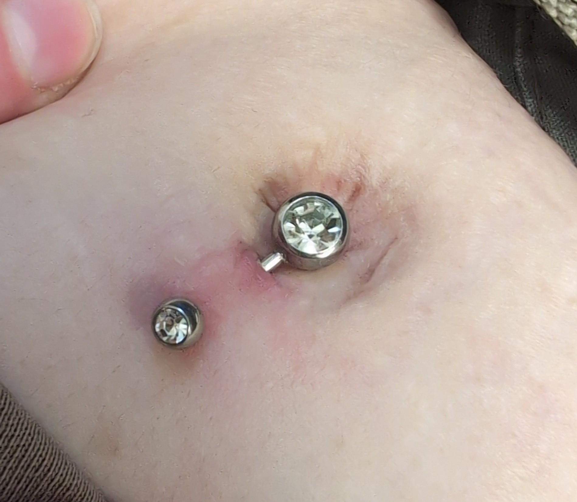 Bauchnabelpiercing rot schlimm? (Bauchnabel, Piercingstudio, rauswachsen)