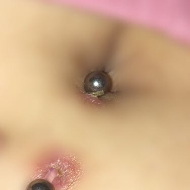 Bauchnabelpiercing Rot Und Kruste Gesundheit Und Medizin Entzundung Heilung