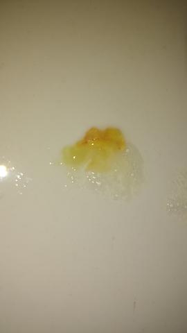 Das ist hier die frage Das ist hier die frage