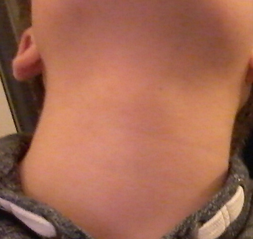 Bei Mif Kommt Langsam Der Adamsapfel Wann Kommt Dann So Die Tiefere Stimme Bin 13 Konnte Es Sein Wenn Ich Eines Morgens Aufdtehe Und Habe Stimmbruch Bei Mif Kommt Langsam Der Adamsapfel Wann Kommt Dann So Die Tiefere Stimme Bin 13 Konnte Es Sein Wenn Ich Eines Morgens Aufdtehe Und Habe Stimmbruch