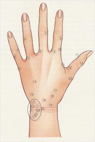 Beim Gitarrespielen schmerz das \