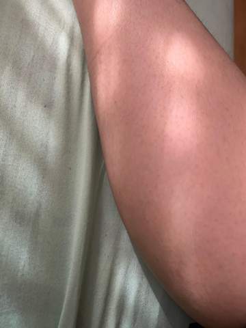 Beim Strecken Bein Verletzen Gesundheit Und Medizin Beine Beim Strecken Bein Verletzen Gesundheit Und Medizin Beine