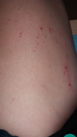 Beine Jucken Total Gesundheit Und Medizin Juckreiz Beine Jucken Total Gesundheit Und Medizin Juckreiz