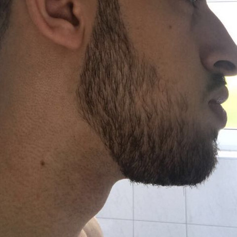 Bekomm Ich Noch Einen Vollbart Haare Bart Bartwuchs