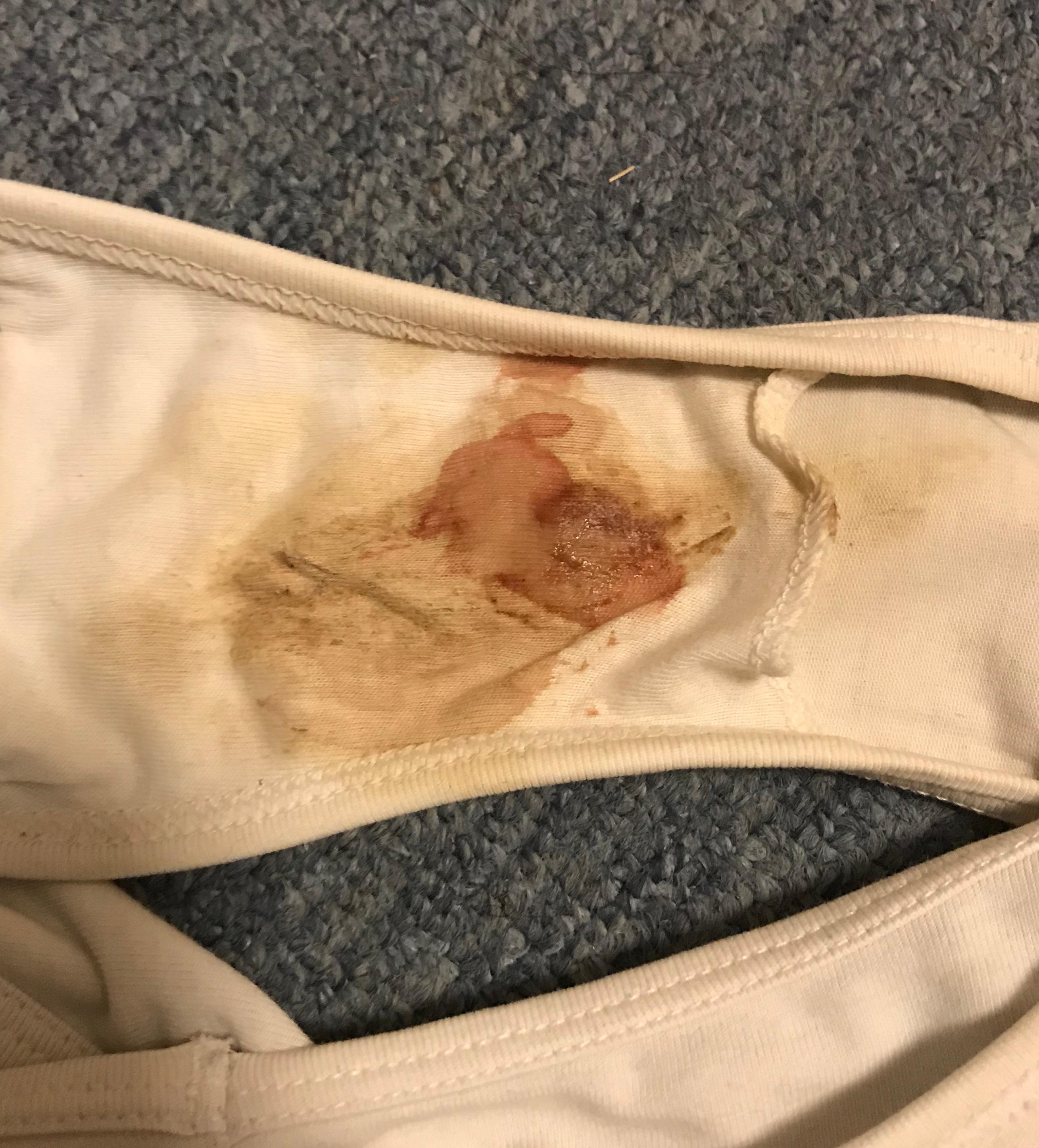 Bekomme ich bald meine Periode? (Gesundheit und Medizin ...