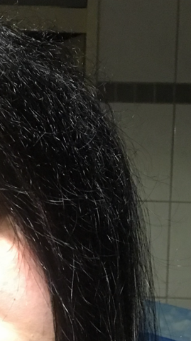 Bekomme Ich Neue Haare Kurze Haare