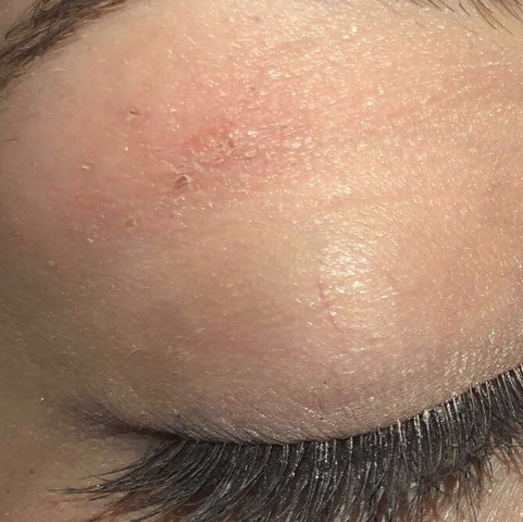 Beschadigte Haut Nach Augenbrauenwachsing Was Kann Ich Dagegen Tun Gesundheit Und Medizin Beauty Tipps
