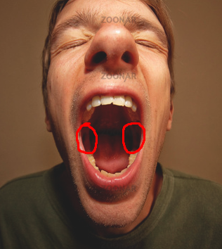 Woher Konnten Meine Beschwerden Beim Kauen Kommen Medizin Schmerzen Zahnschmerzen Woher Konnten Meine Beschwerden Beim Kauen Kommen Medizin Schmerzen Zahnschmerzen