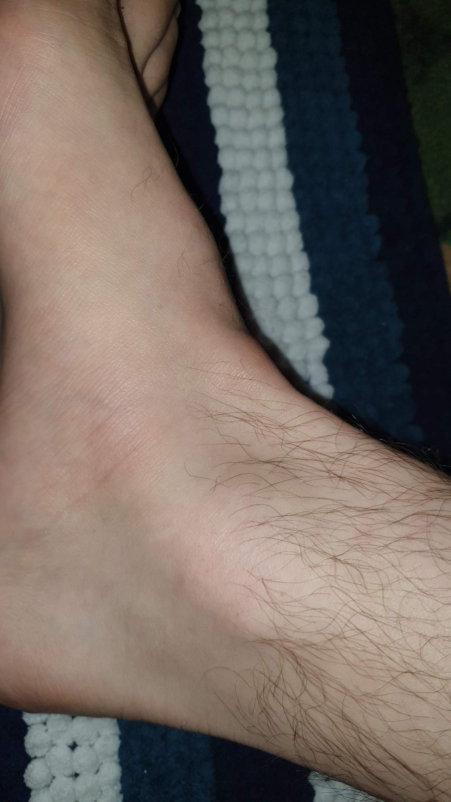 Beule am Fußrücken? (Füße, Fußschmerzen)