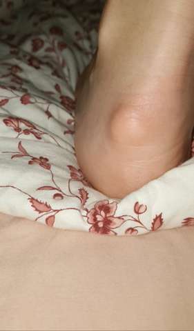 Beule An Der Ferse Fuss Was Kann Das Sein Orthopade Beule An Der Ferse Fuss Was Kann Das Sein Orthopade