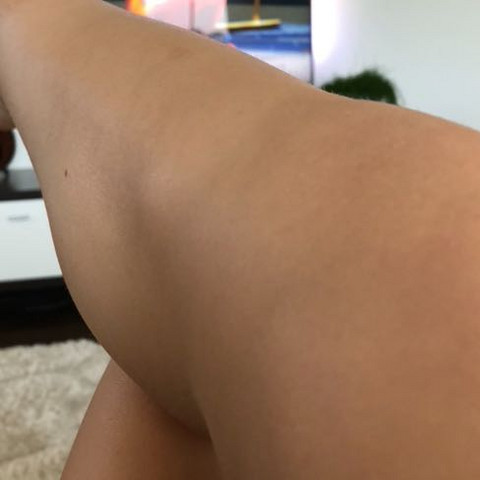 Beule Auf Schienbein Unter Knie Gesundheit Und Medizin Arzt Krankheit Beule Auf Schienbein Unter Knie Gesundheit Und Medizin Arzt Krankheit