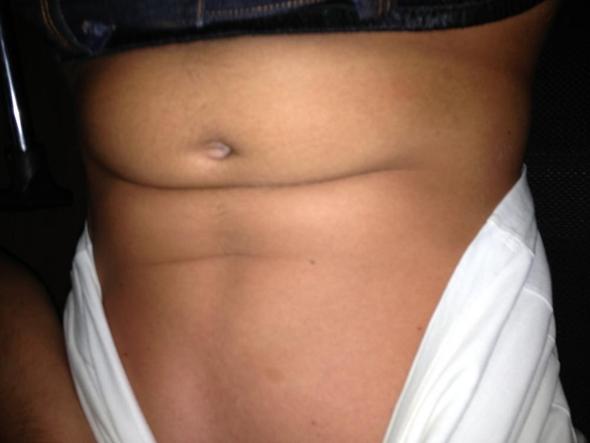 Bierbauch Dicker Bauch Hilfe Fitness Bierbauch Dicker Bauch Hilfe Fitness