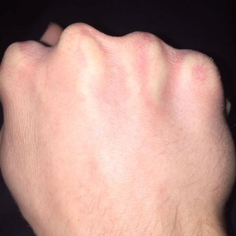 Bin 16 Und Hab Muskelzuckungen Angst Als Bin 16 Und Hab Muskelzuckungen Angst Als