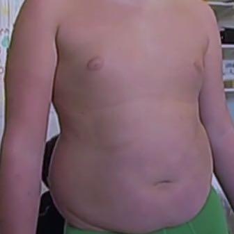 Hier ist ein Bild von meinem Bauch - (Übergewicht, Übergewicht Jugendlicher)