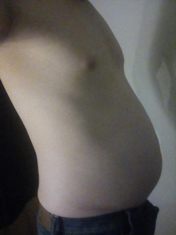 Bin Ich Zu Dick 15m75kg Gesundheit Dicker Bauch Bin Ich Zu Dick 15m75kg Gesundheit Dicker Bauch