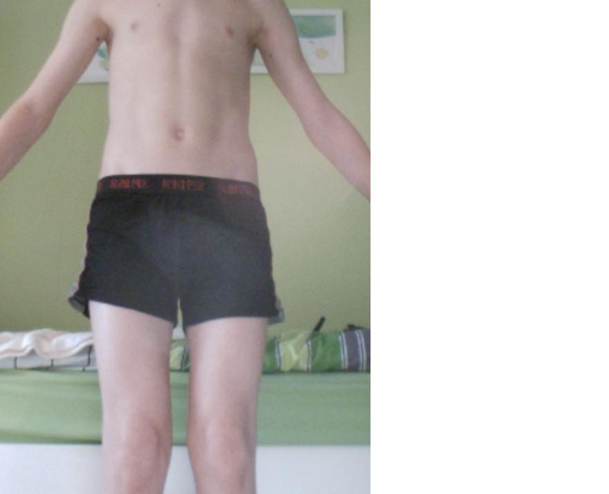 Bin ich zu dünn (mit Bilder)? (Gewicht, Größe)