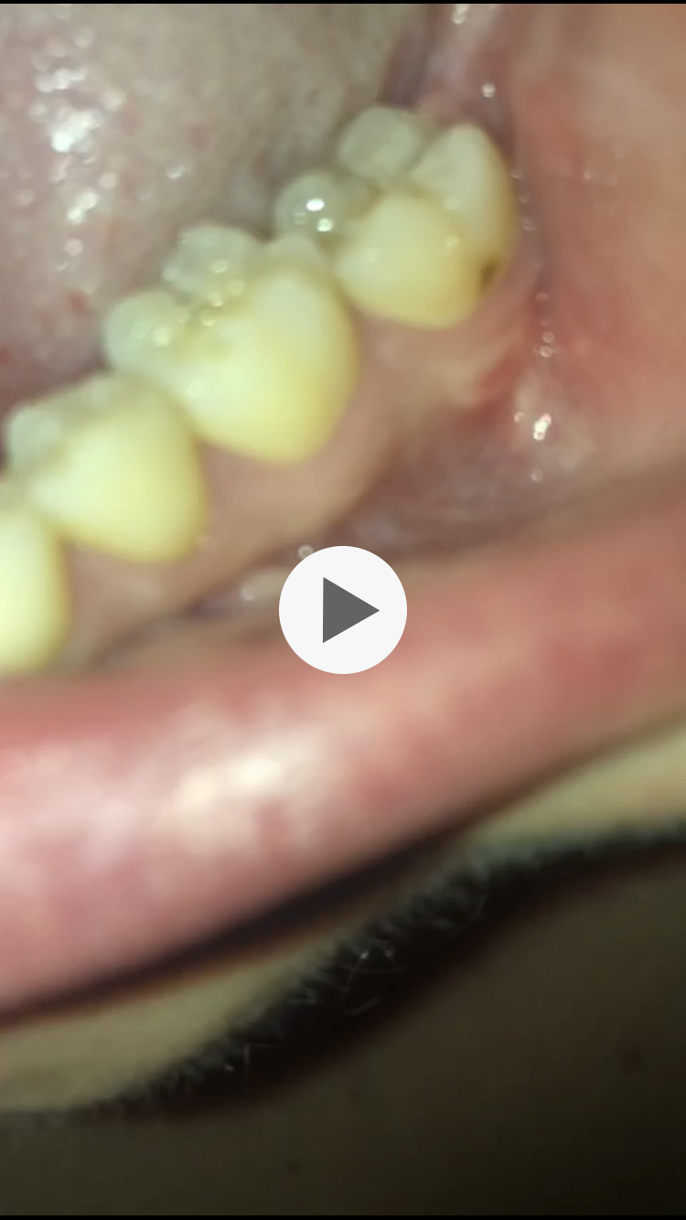 Bitte Helft Mir Es Tut So Weh Gesundheit Und Medizin Zahne Zahnarzt Bitte Helft Mir Es Tut So Weh Gesundheit Und Medizin Zahne Zahnarzt