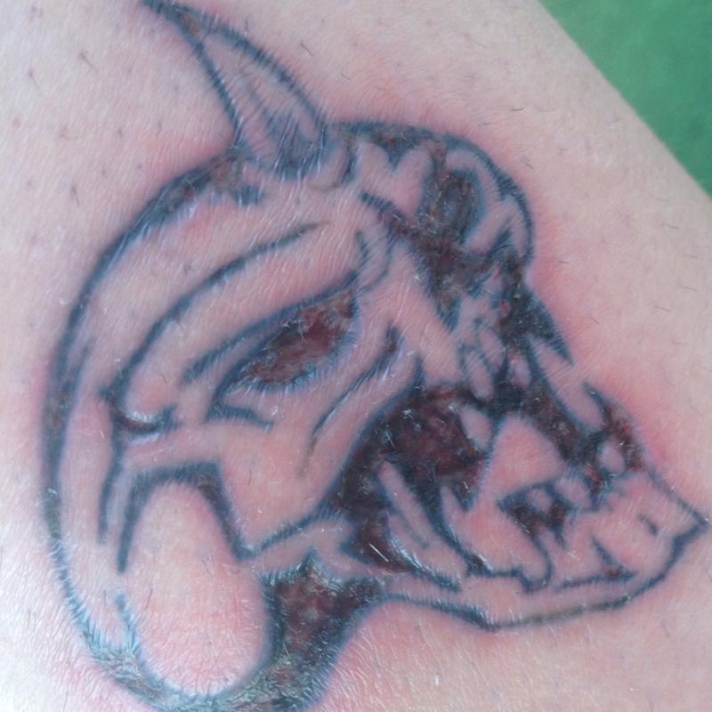 Bitte um hilfe zwecks meines Tattoos! (Schmerzen, Tattoo, Entzündung)