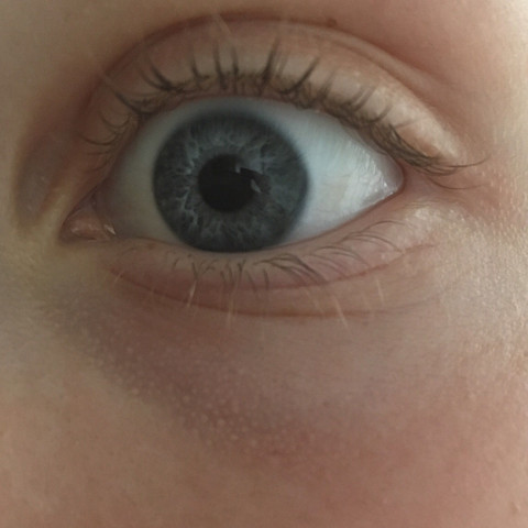 Mein Auge - (Arzt, Haut, Augen)