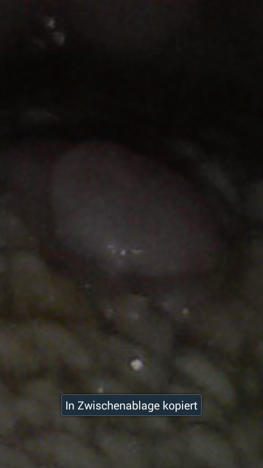 View Pickel Auf Der Zunge Hinten Erkältung Background