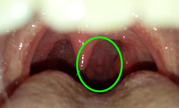 bild 2 - (Gesundheit, Medizin, Arzt)