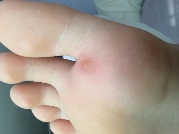 Ein wirklich interessantes Bild von meinem Fuß xD - (Schmerzen, Füße, Entzündung)