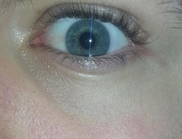 auge.... - (Augen, Augenringe)