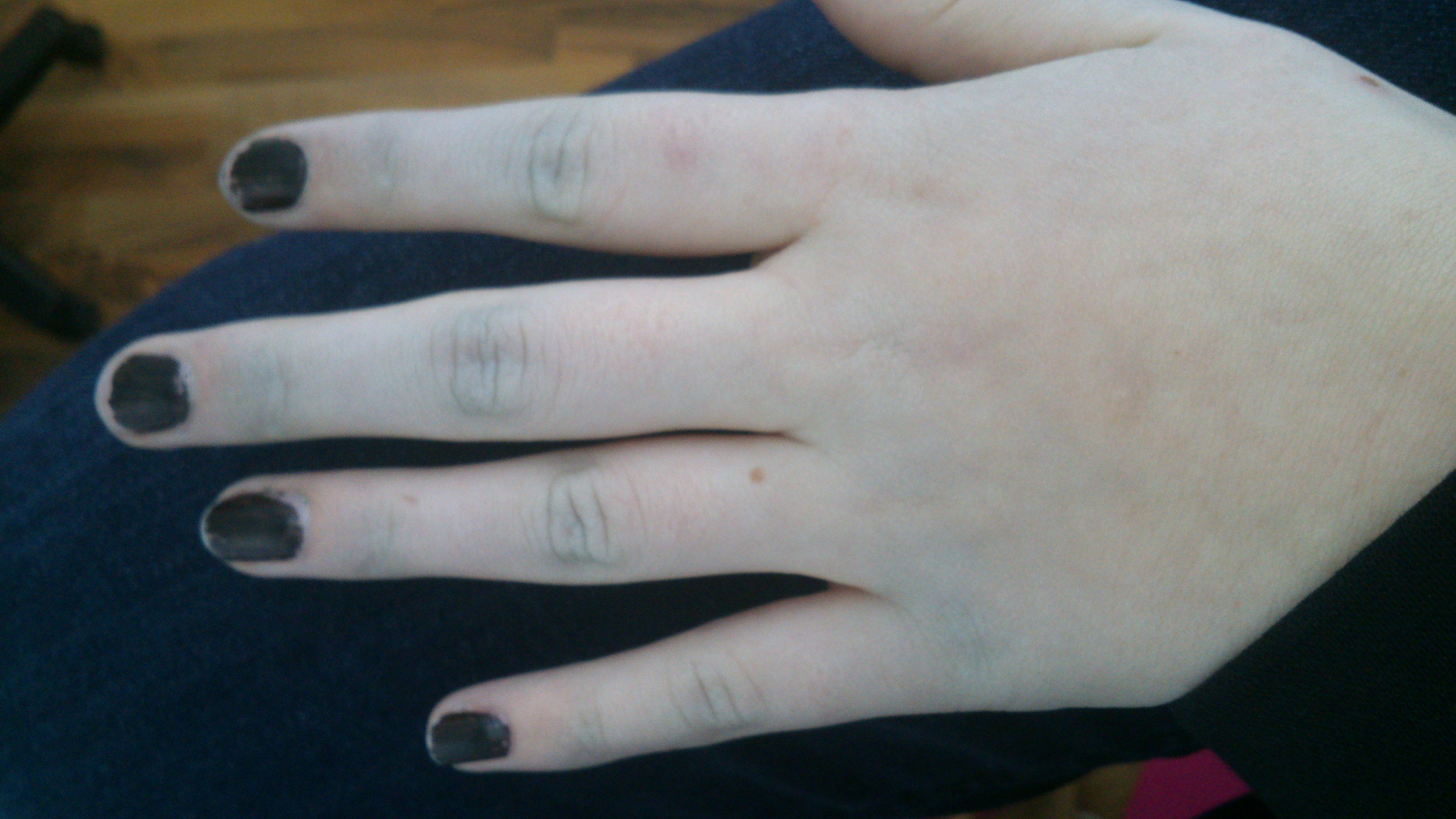 was tun gegen blasse haut