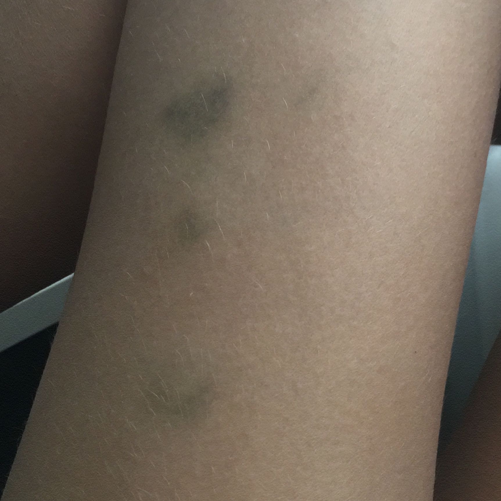 Knie Blau Ohne Grund Quotes Type Knie Blau Ohne Grund Quotes Type