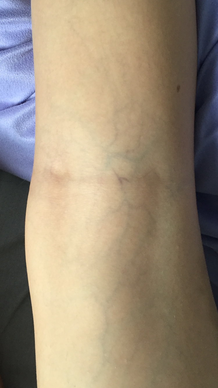 Warum Sieht Man Meine Adern So Stark www.gutefrage.net