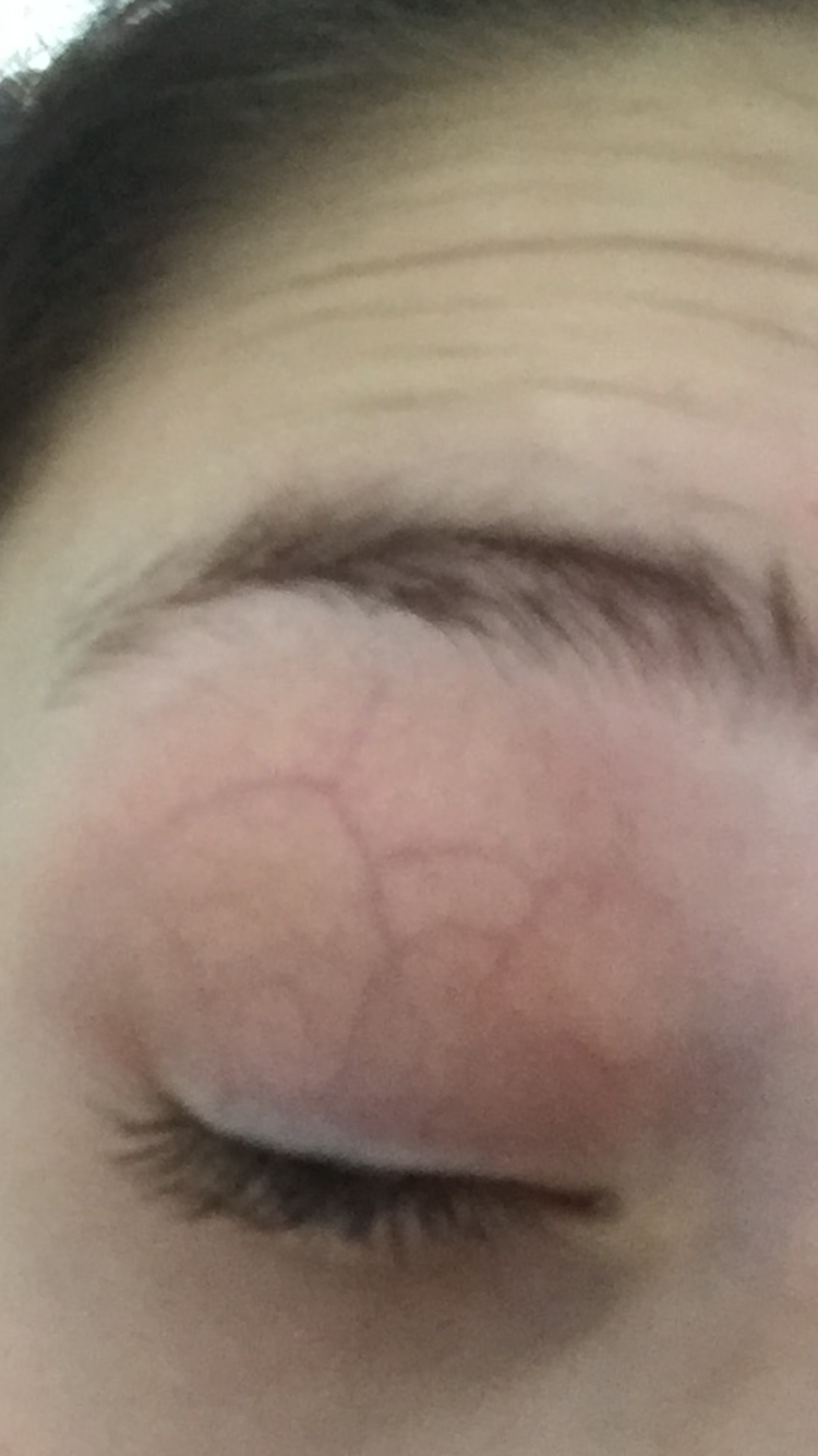 Warum Sieht Man Meine Adern So Stark www.gesundheitsfrage.net