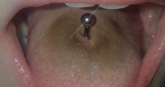 Blauer Fleck Um Zungenpiercingg Gesundheit Und Medizin Piercing Zungenpiercing Blauer Fleck Um Zungenpiercingg Gesundheit Und Medizin Piercing Zungenpiercing