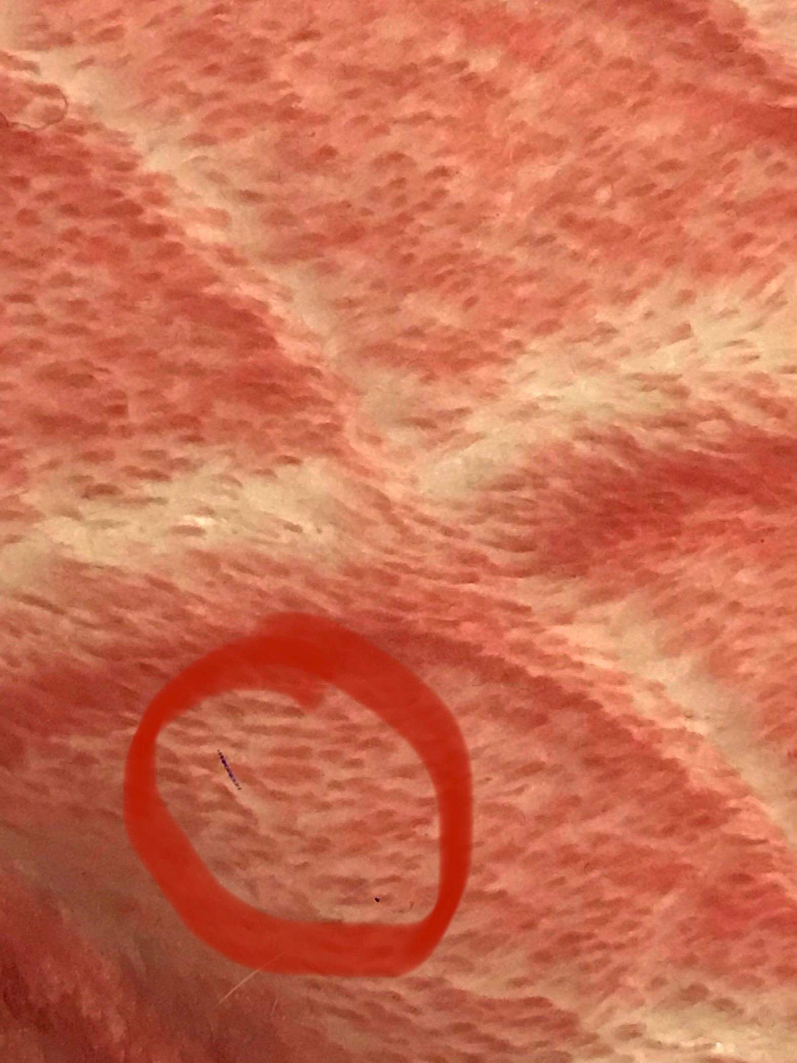 Blauer Strich In Iphone Kamera Technik Handy Technologie 