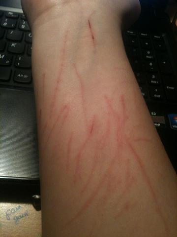 Bleiben diese Narben für immer? (Katze) (Menschen, Tiere, Leben)