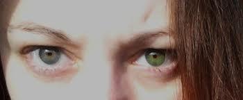 zwei verschiedene augenfarben - (Augen, Blindheit)