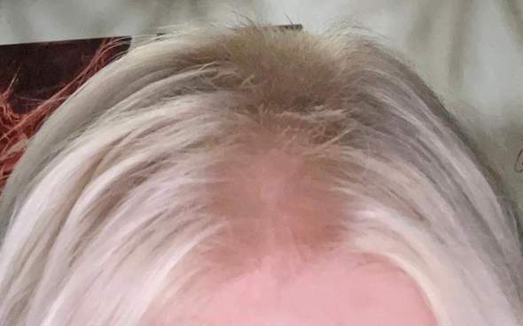 Blonde haare // haarausfall?