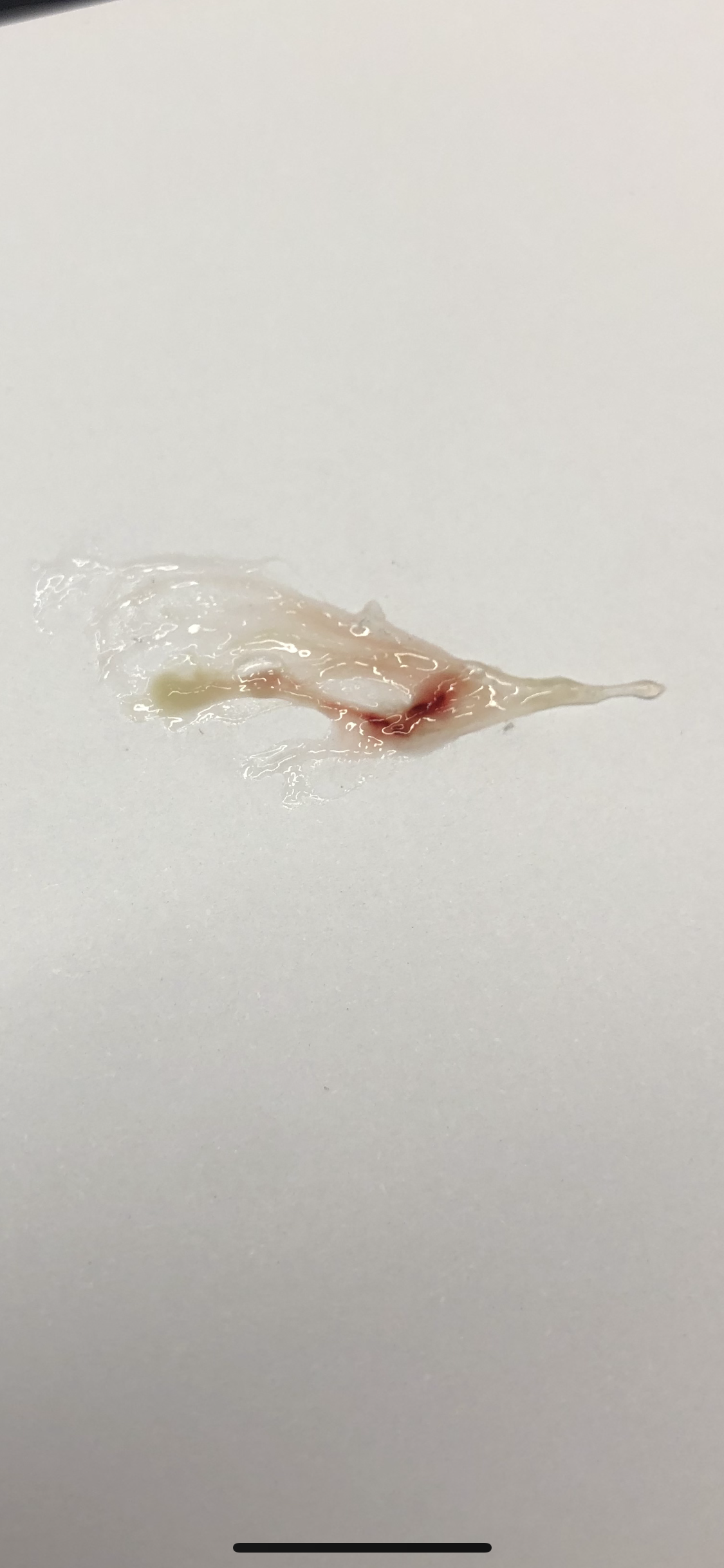 Blut Husten