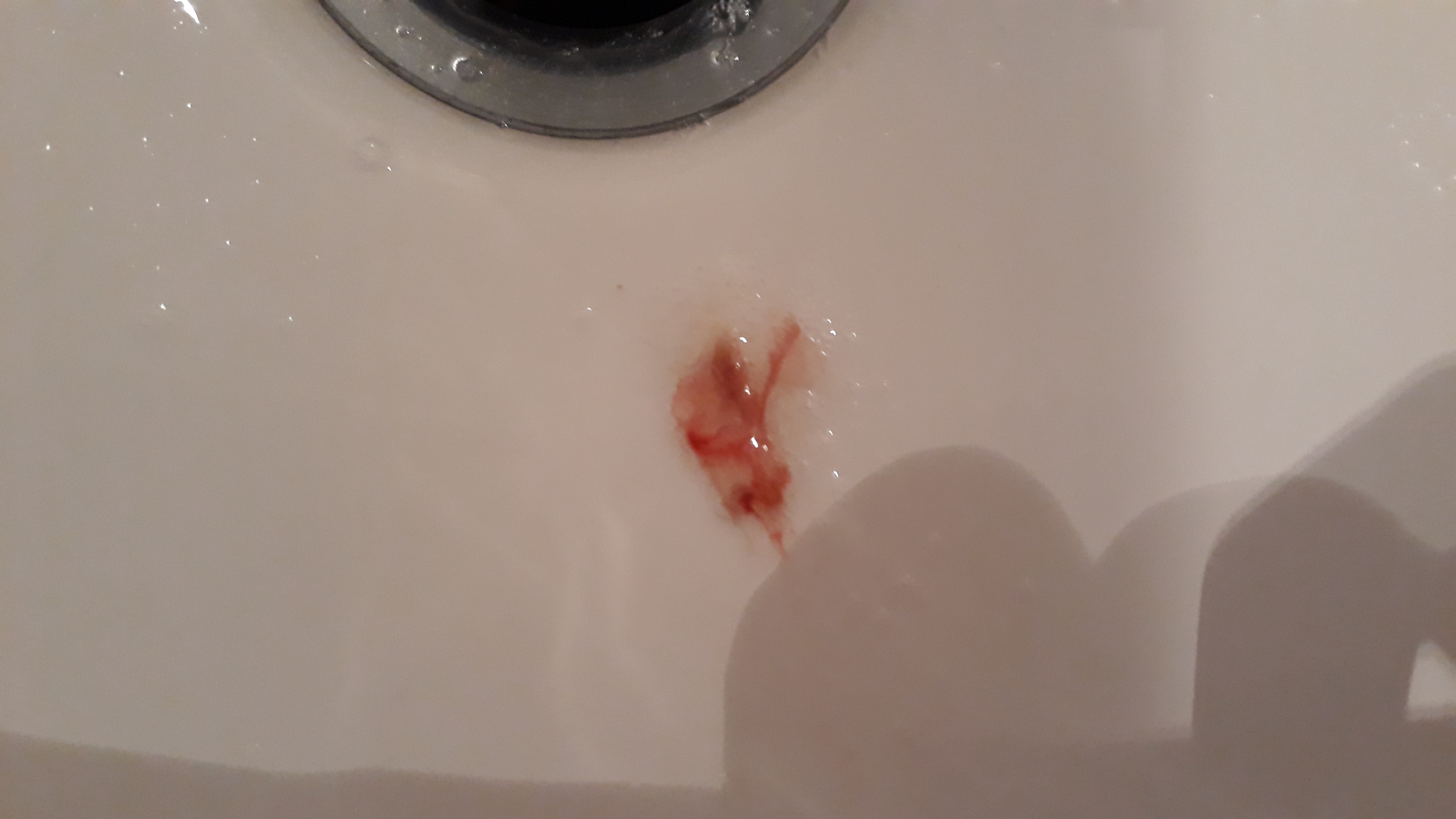 blut gespuckt was konnte das sein gesundheit und medizin medizin