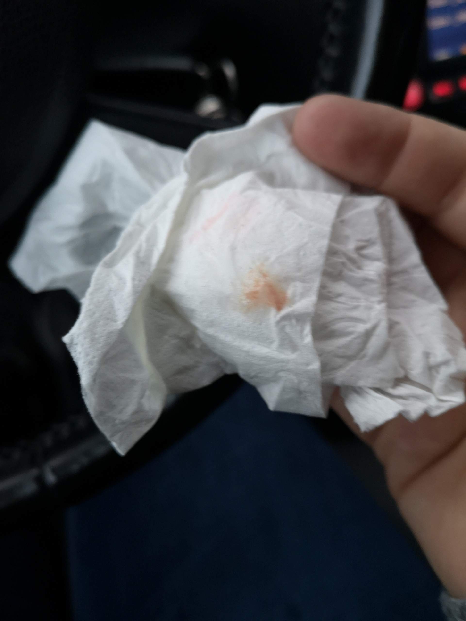 Blut Husten Warum Gesundheit Und Medizin Blut Husten Warum Gesundheit Und Medizin