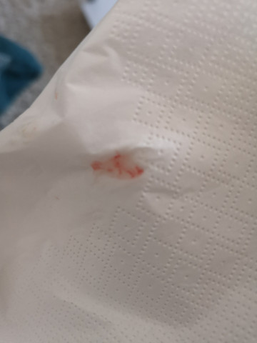 Blut Husten Warum Gesundheit Und Medizin Blut Husten Warum Gesundheit Und Medizin