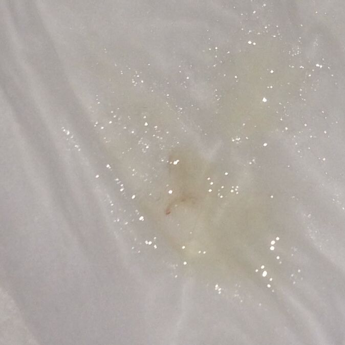 Blutiger Auswurf Morgens Ohne Husten - Captions Beautiful