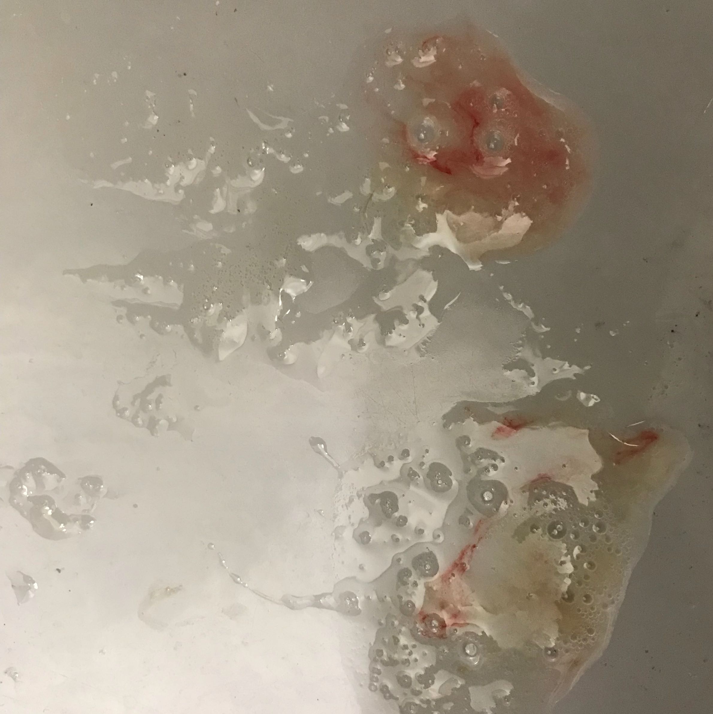 Blut Im Mund Jeden Morgen Gesundheit Und Medizin Medizin Schmerzen Blut Im Mund Jeden Morgen Gesundheit Und Medizin Medizin Schmerzen