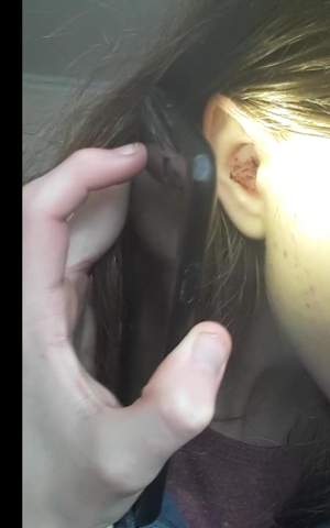 Blut Im Ohr Gesundheit Blut Im Ohr Gesundheit